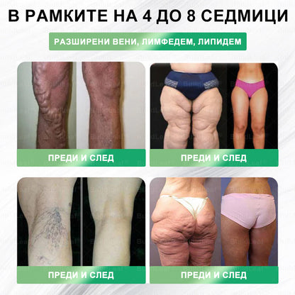 ⭐⭐ 🎁 Остават само 10 кутии! Офертата е ограничена във времето, допълнителни 50% отстъпка! Възползвайте се от тази възможност, за да живеете по-строен и по-енергичен живот. Ако я пропуснете, ще трябва да чакате до следващата година!